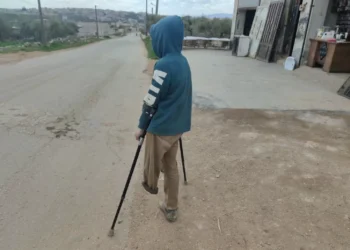 Amputated Limbs, Enduring Pain: The Suffering of Syria’s War Wounded