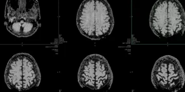 Healthcare Is AI’s Hardest Test