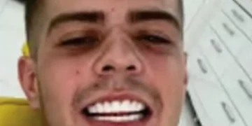 The ‘Turkey teeth’ selfie that helped police bring drug dealer down